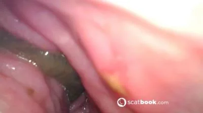Endoscope In My Ass (Sweet Tinqerbell) 19 April 2025 [FullHD 1080p] 647 MB