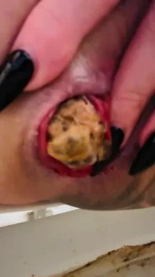 Look at that prolapse! (Taylor Nicole) 22 April 2025 [UltraHD 4K] 45.5 MB