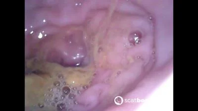 Show Inside Of My Ass With Endoscope (Sweet Tinqerbell) 28 October 2025 [FullHD 1080p] 378 MB