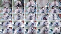 Gape With Big Speculum 2 (Sweet Tinqerbell) 26 January 2026 [HD 720p] 178 MB
