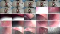 Gape With Speculum (Dildo, Anal) 27 February 2026 [FullHD 1080p] 118 MB