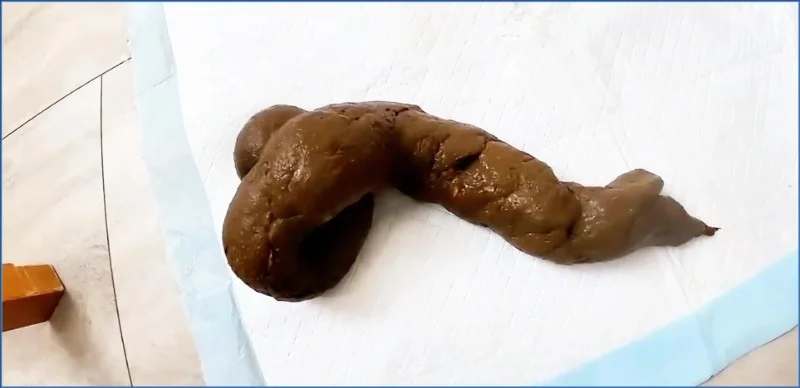 Pulsifer Paprocki (Pulsifer Paprocki – Scared Shitless 5 Day Post-op Shit) Scat, Piss: USA FullHD 1080p