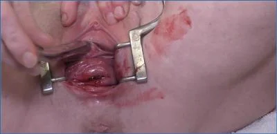 Dirtygardengirl in Solo Scat Play: Period, Peehole & Prolapse clip