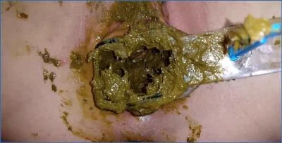Anna Coprofield Takes You On A Wild Polish Scat Outing - Farting