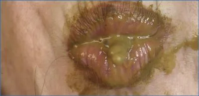 Dirtygardengirl Takes Hold in Upclose Personal Enema Smearing Show