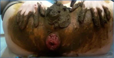 Scatlina's Solo Show: Extreme Anal Prolapse and Big Shit Smearing