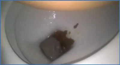 Sarah's Extreme Period Play and Diarrhea Fetish video